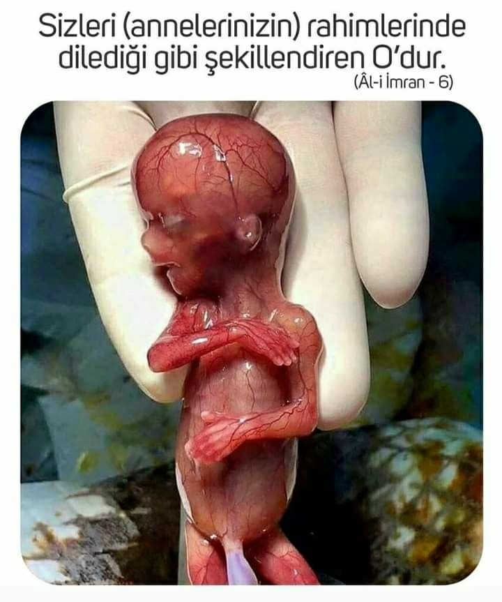 Mehmet