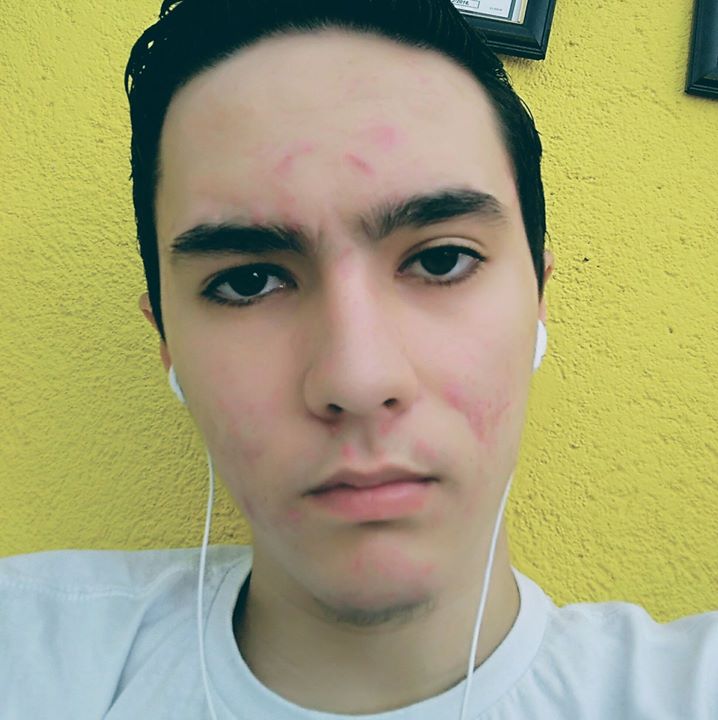 Ezequiel