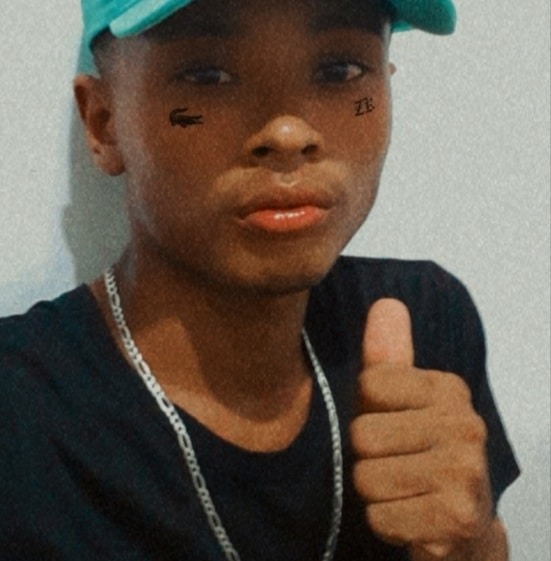 RD