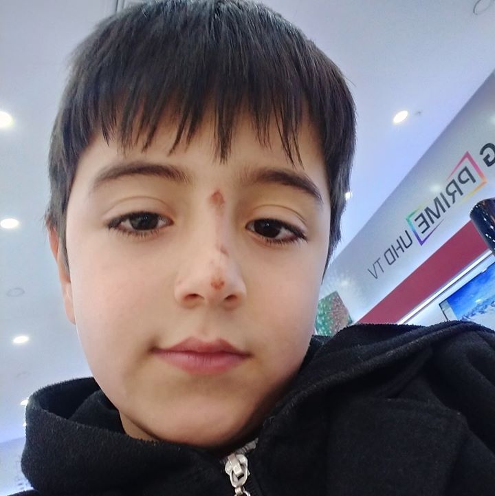 Yunus