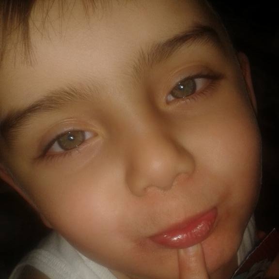 Servet