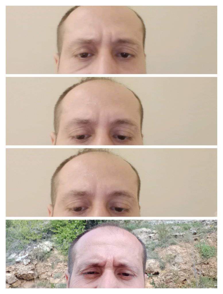 Yalçin