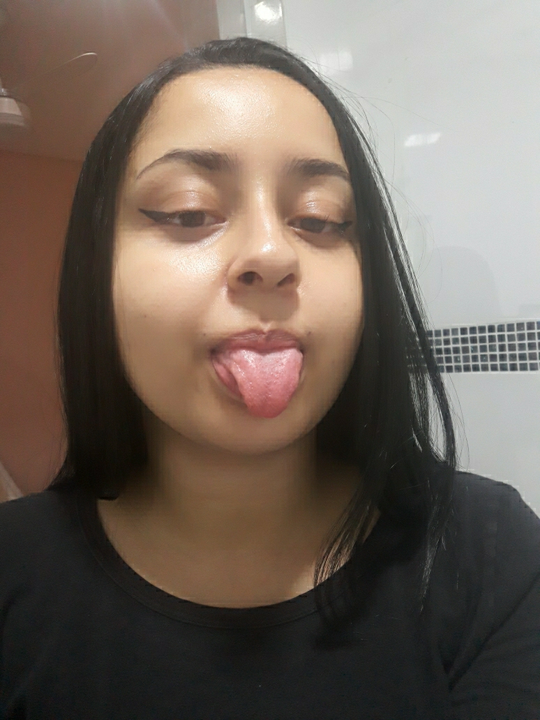 Assiste