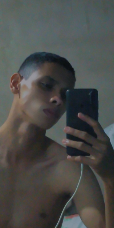 Aledson
