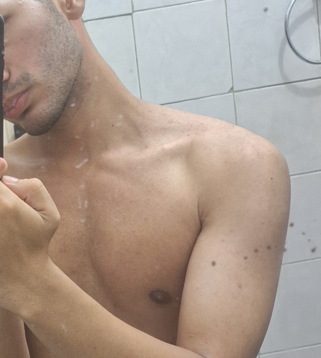 Fikzer