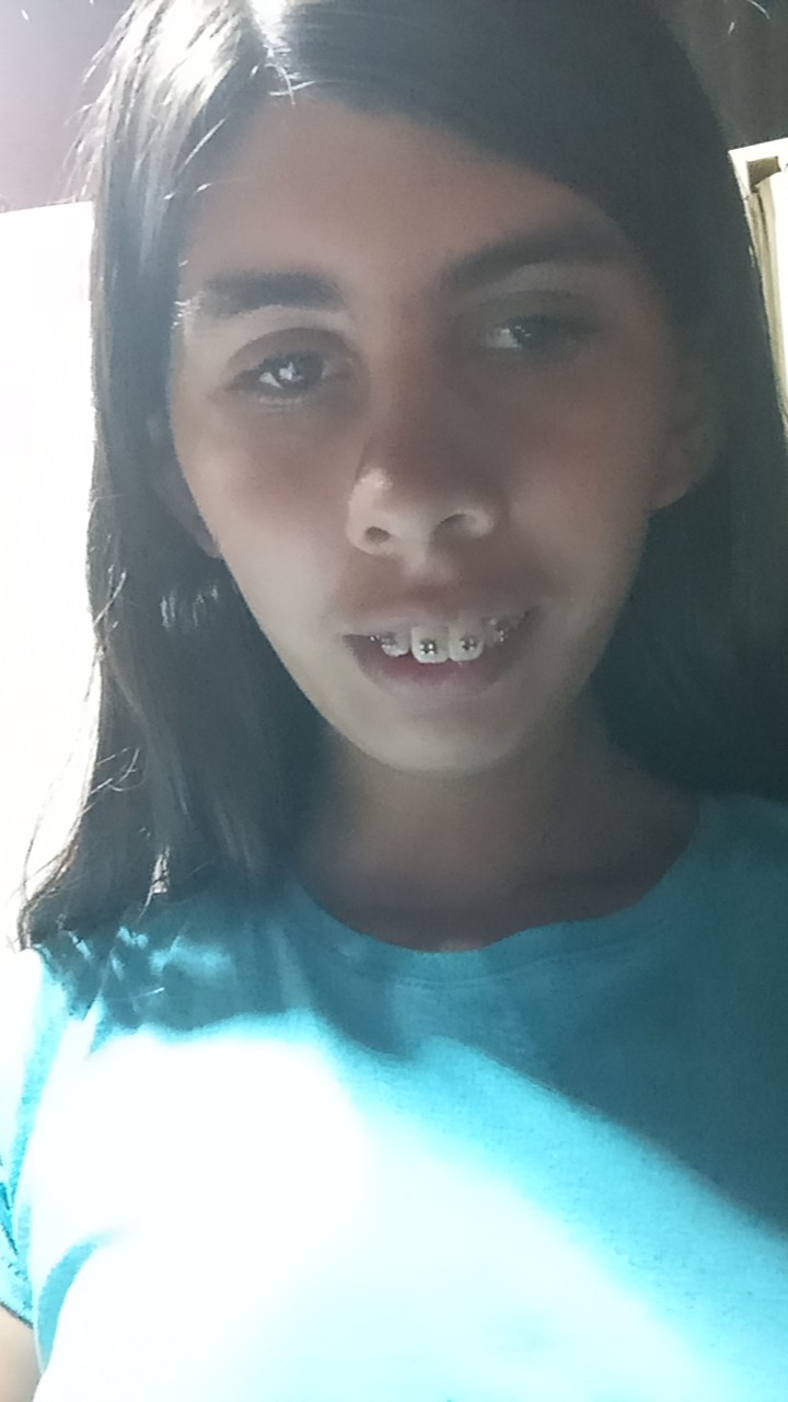 Kimberly