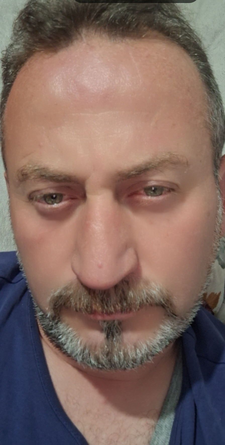 hakan