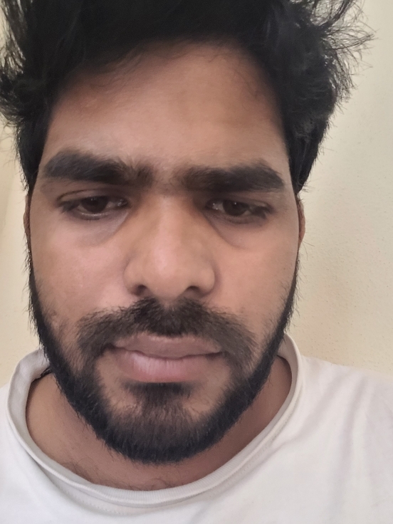 Anand