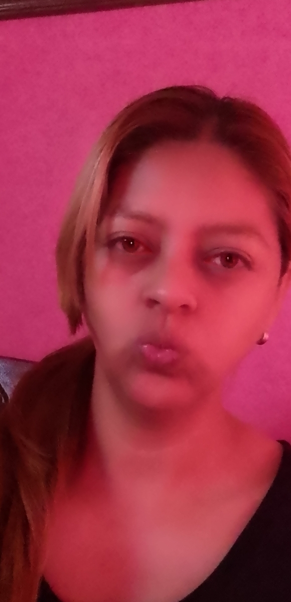 Elvis