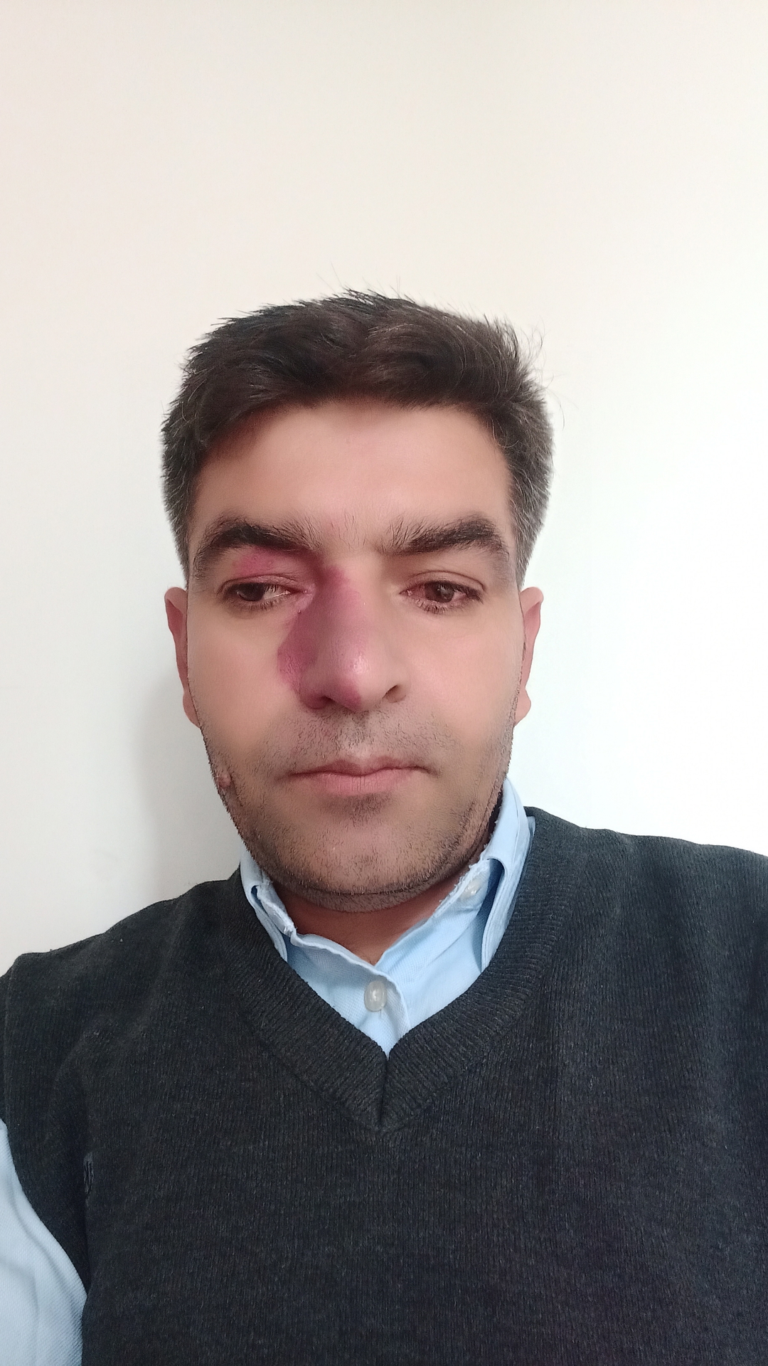 Mehmet