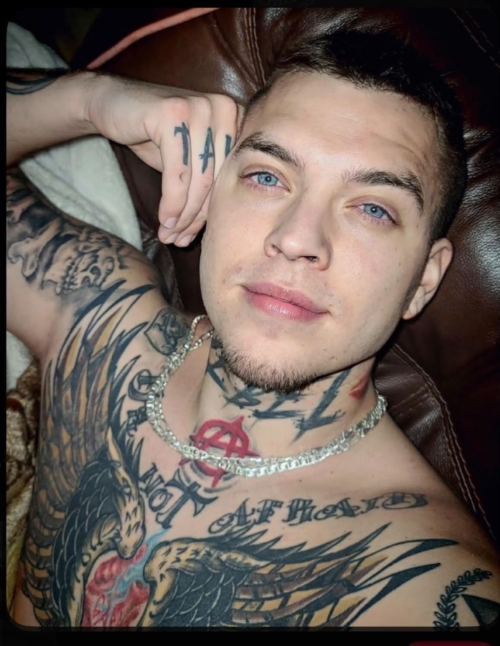 Anthony