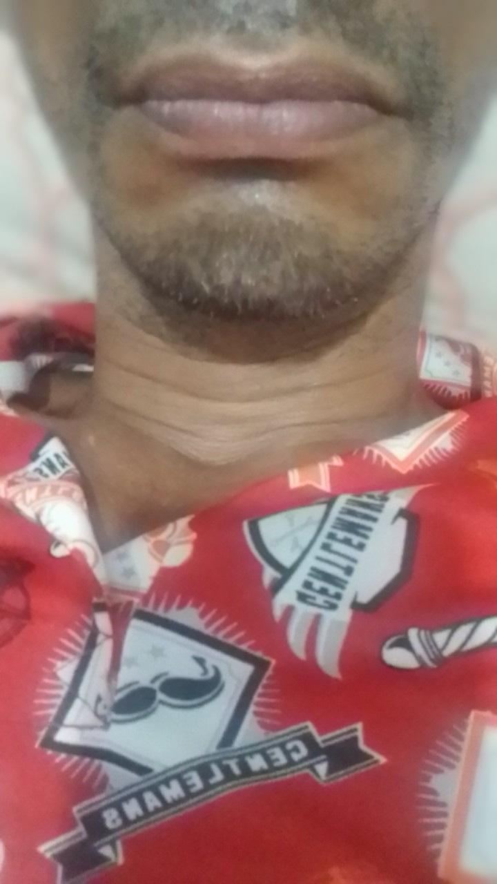 Jose
