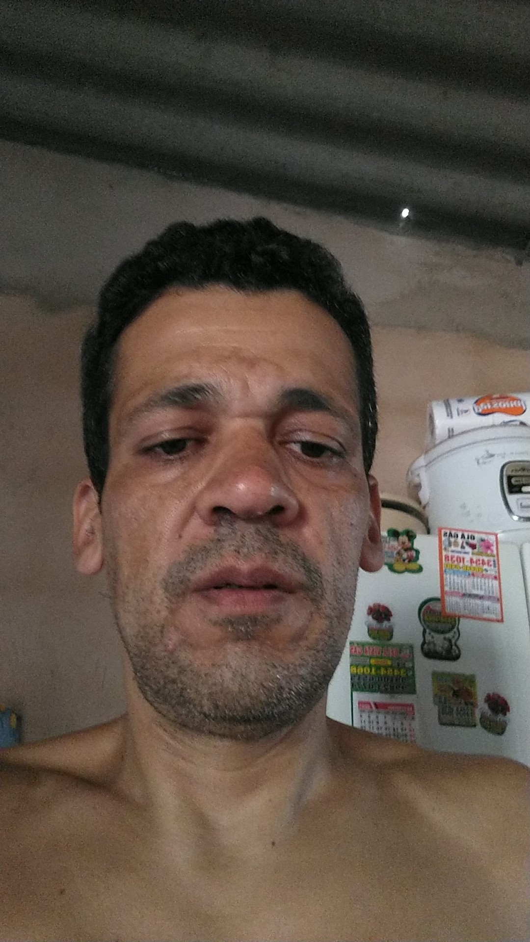 Iranildo