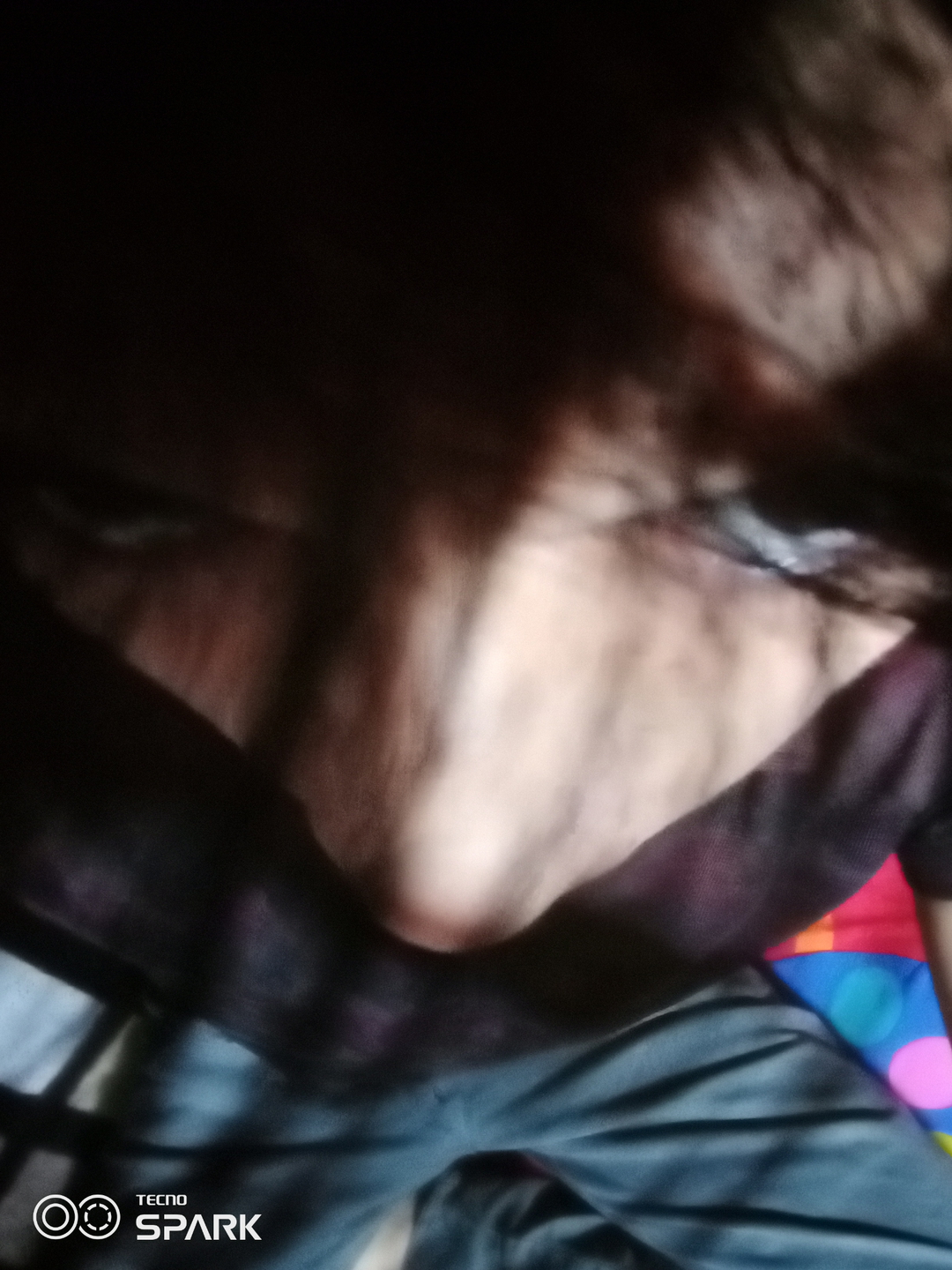 Nose