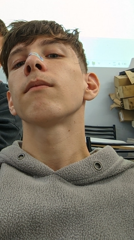 TriedAxel