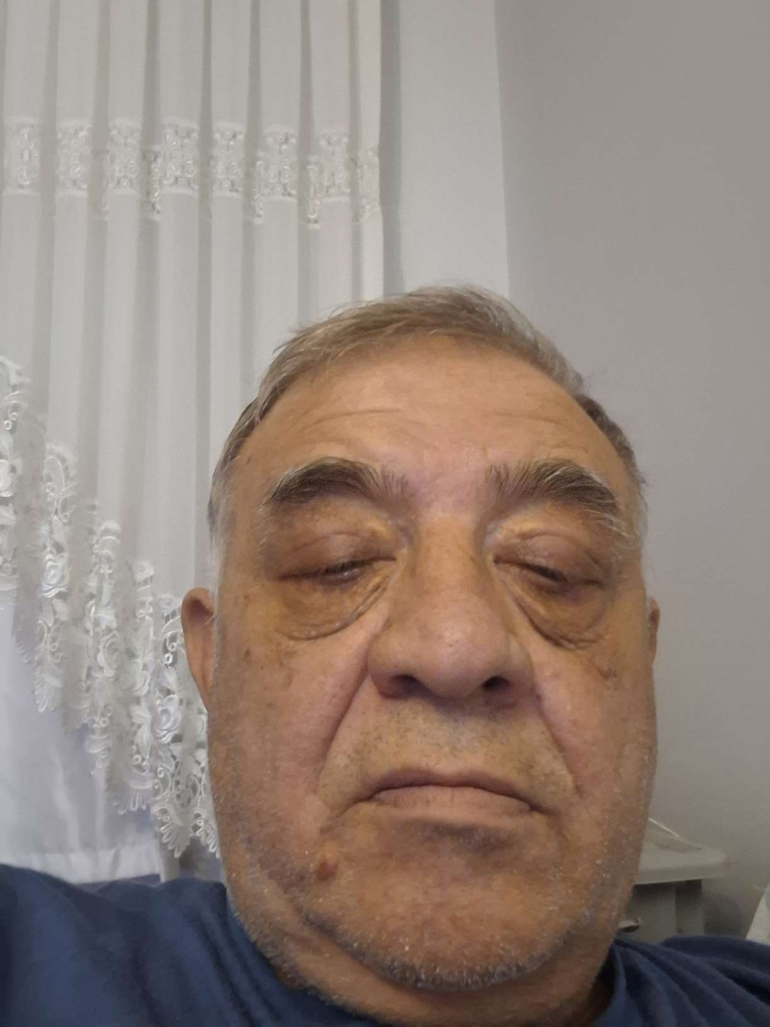 Nedim