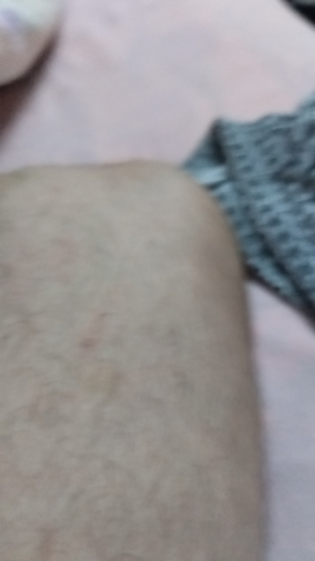 Derman