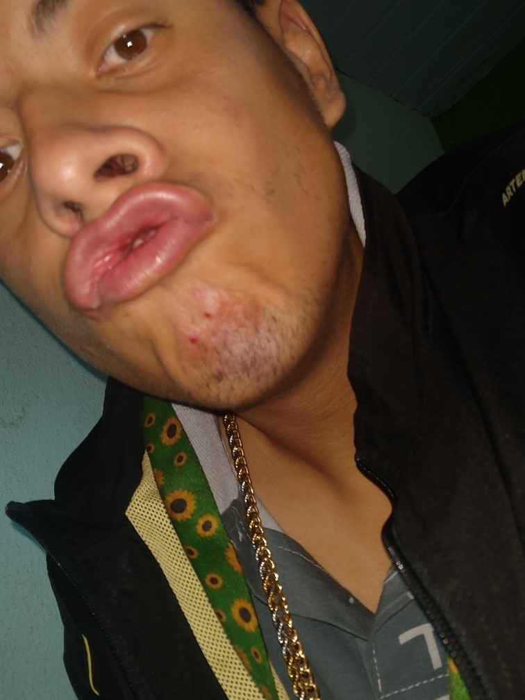 Jaderson