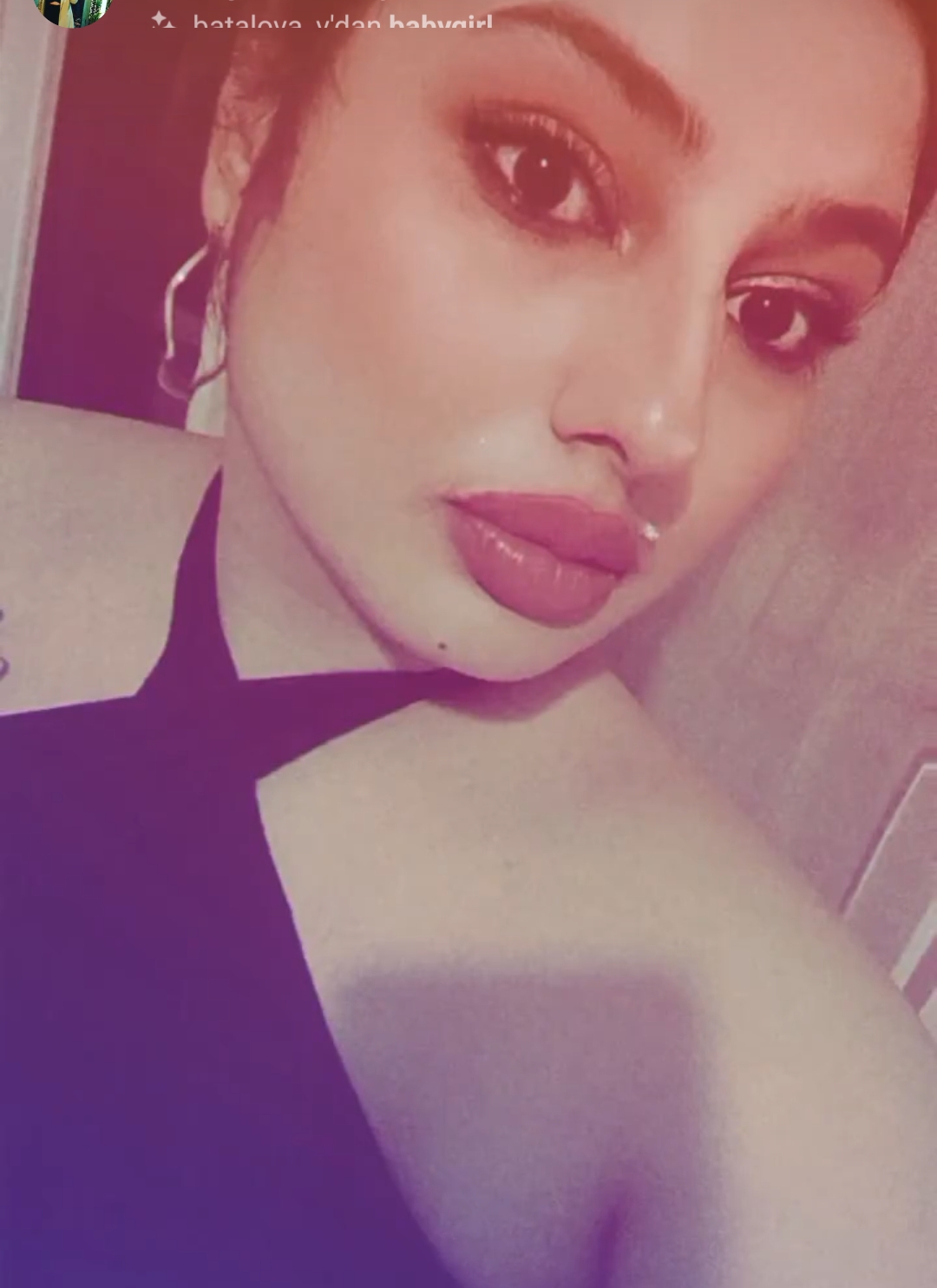 Buse