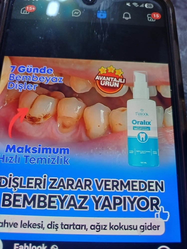 Mert