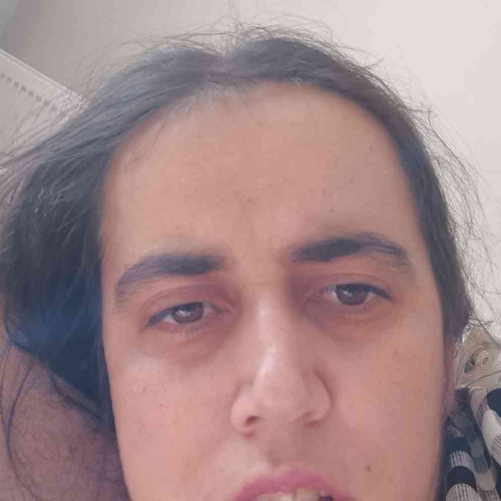 Rabia