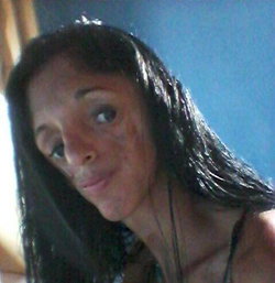Aline