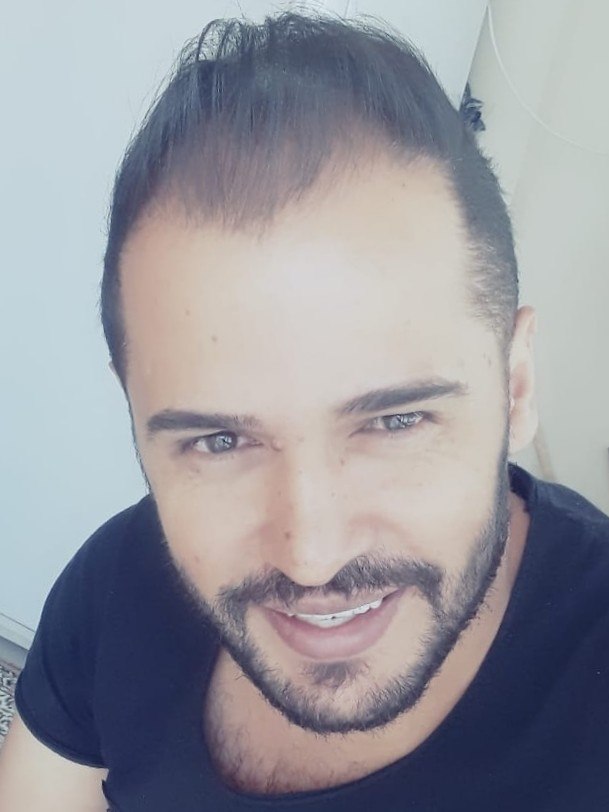 Erdo