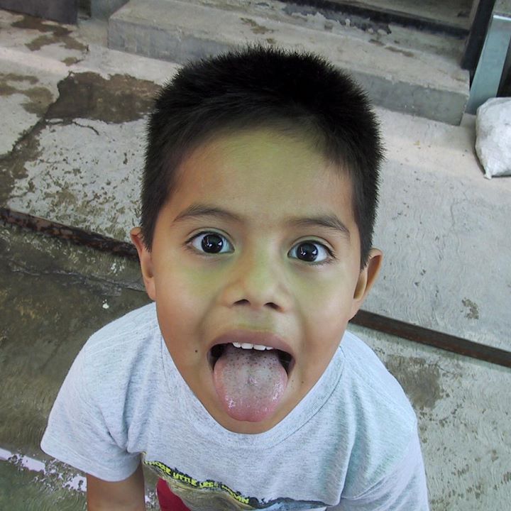 Braulio