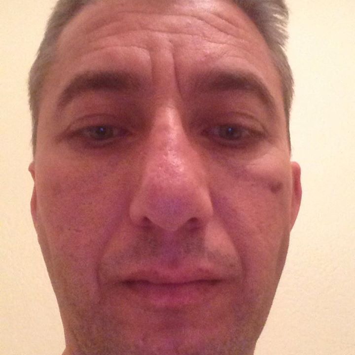Erkan